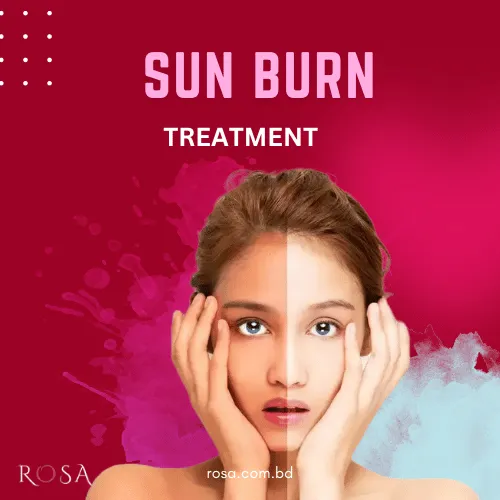 Face sun burn solution rosa cosmetics shop